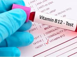 Book Vitamin B12 Test